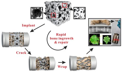  Hydroxyapatite – En Revolutionerande Biokeramik för Benreparationer och Tandläkerimedicin!